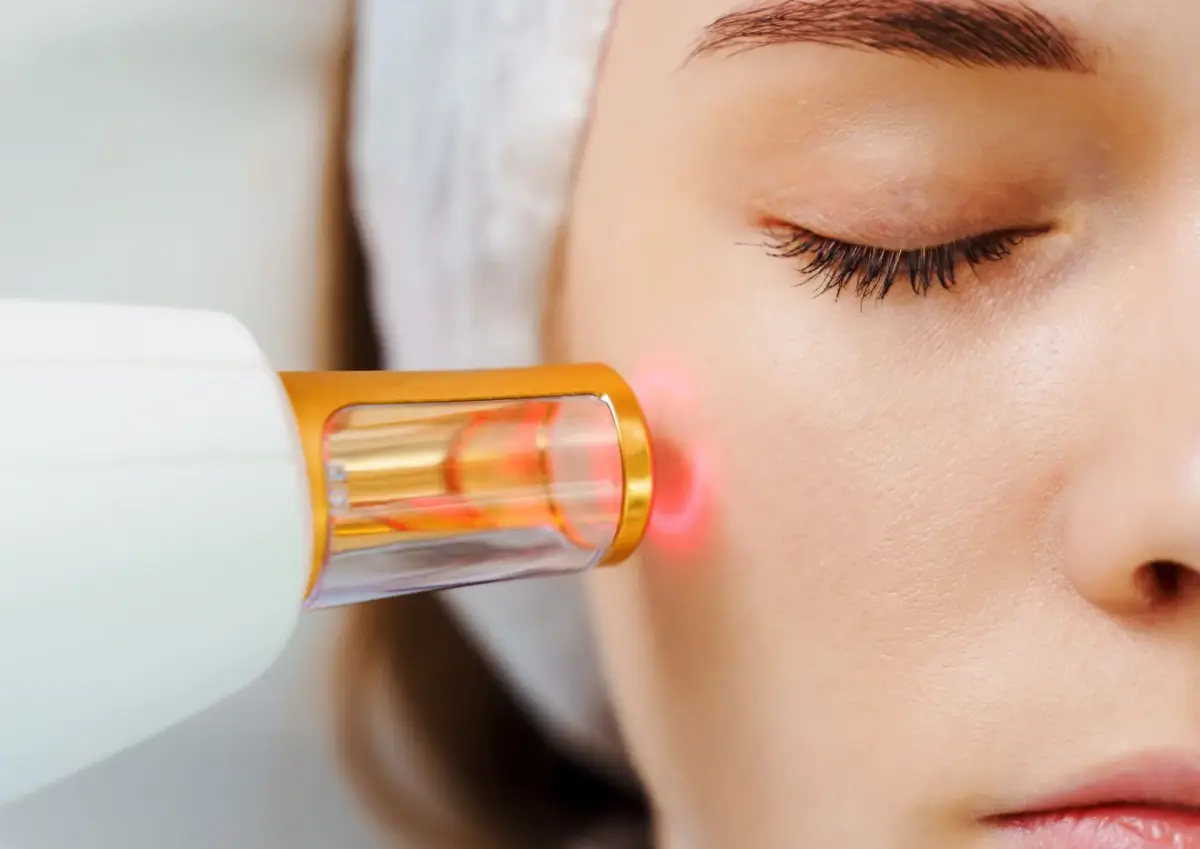 Laser Removal (Kutil, Skin Tag, Ketuat)